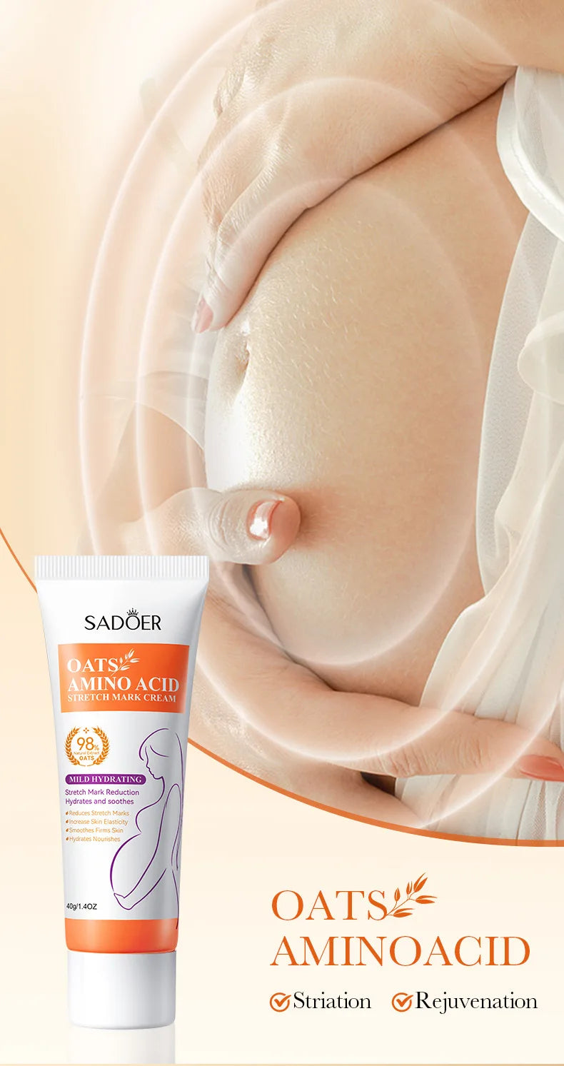 Stretch Marks Permanent Removal Cream