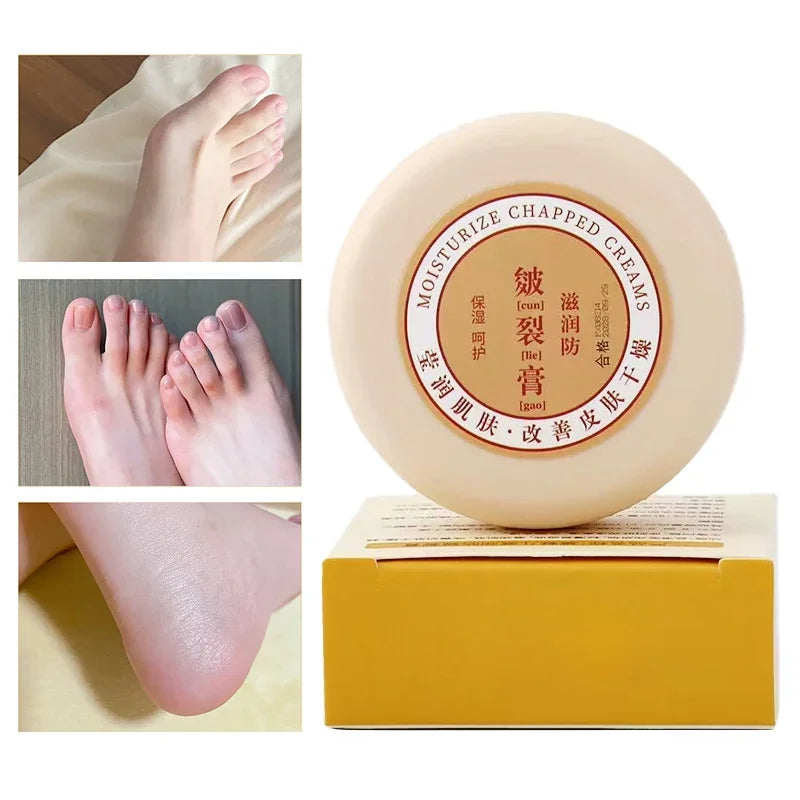 20g Heel Cracked Repair Oil Cream
