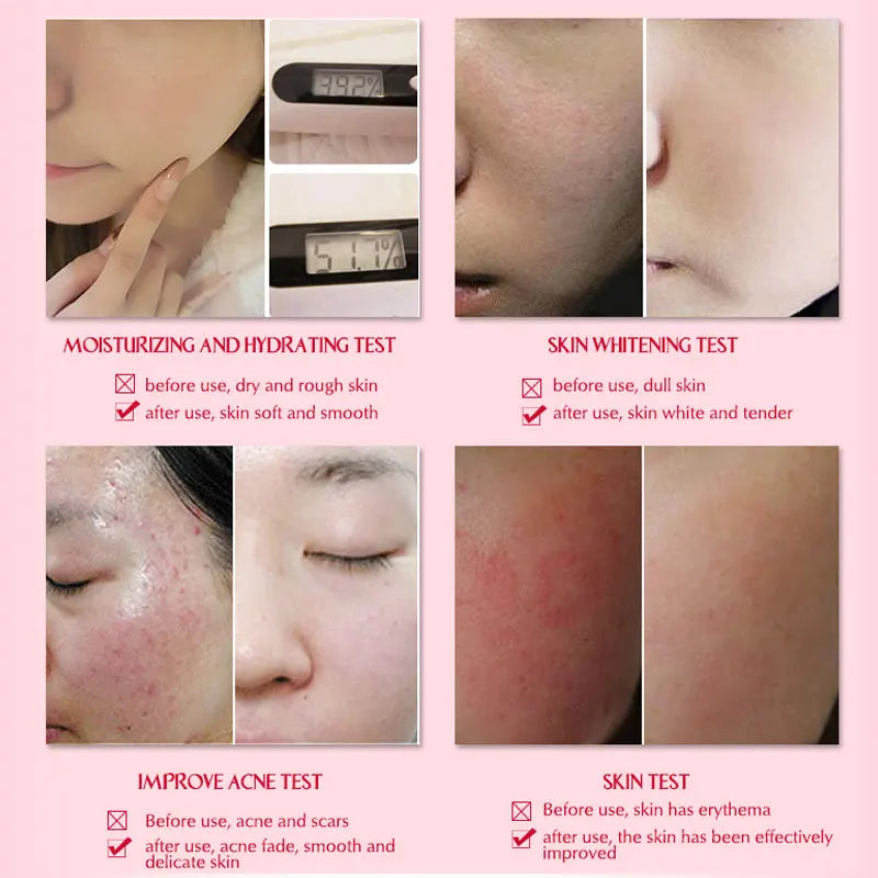 ARTISCARE Snail Serum 3pcs Moisturising Face Repair