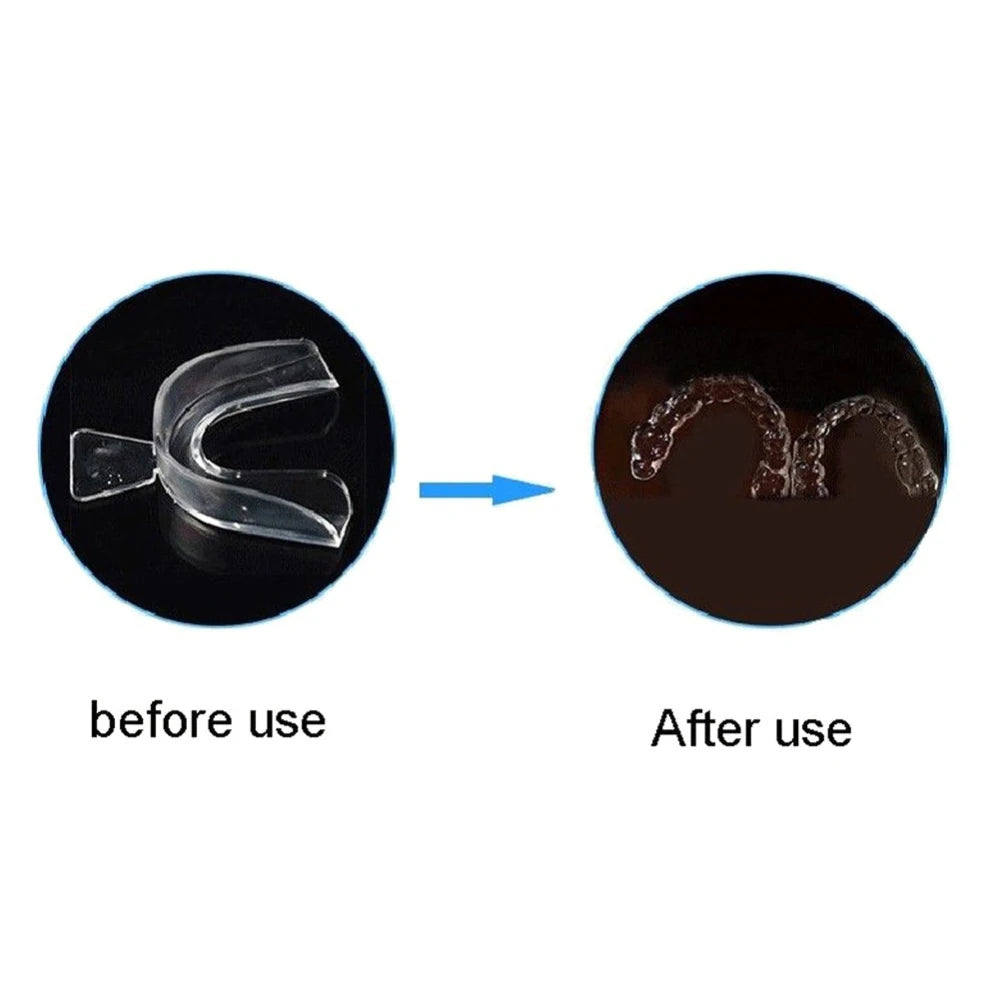 Anti Snoring Sleeping Mouth Guard