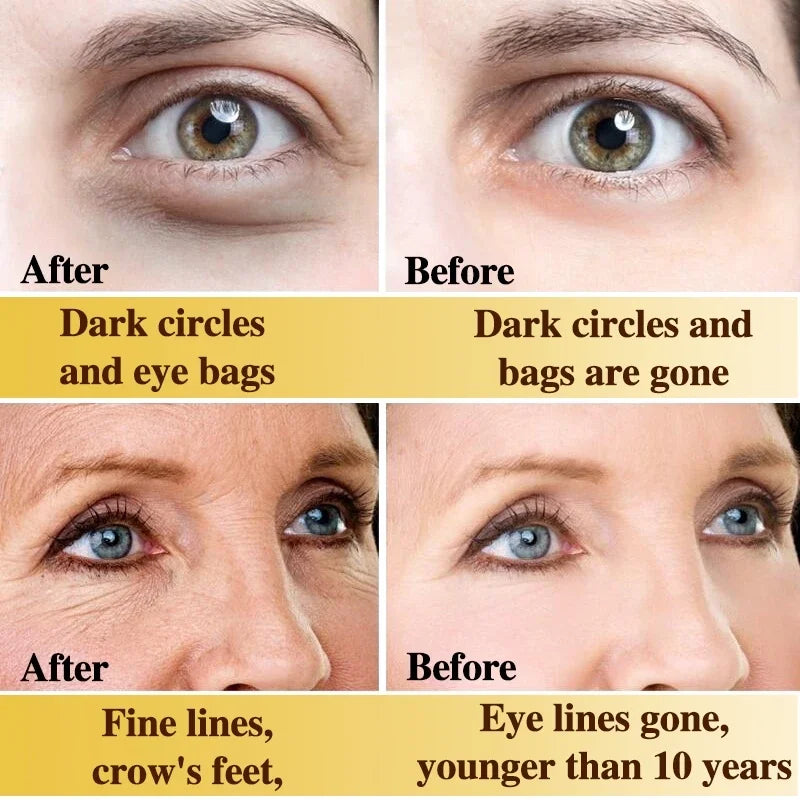 Remove Eye Bags Eye Cream