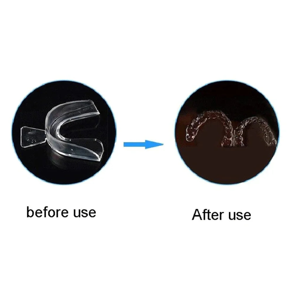 Anti Snoring Sleeping Mouth Guard