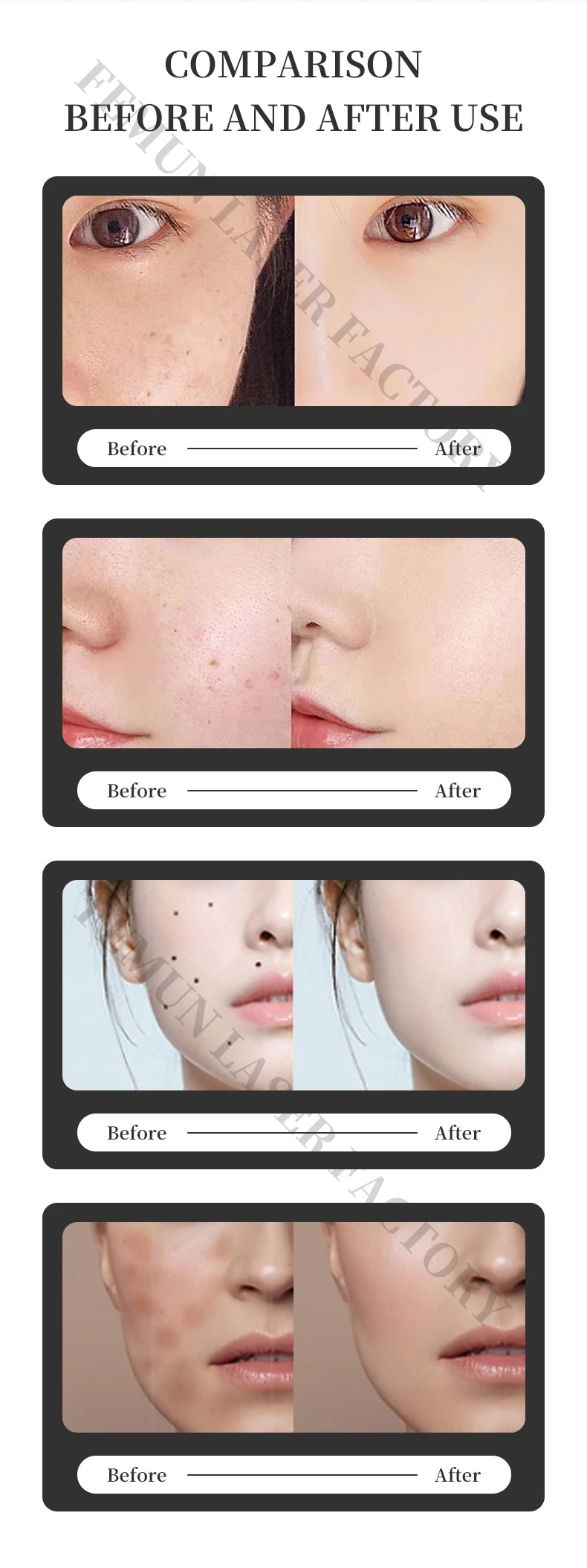 Professional 2 IN 1 Diode Laser 4000w Hair Removal Machine