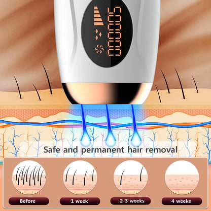Laser Epilator Laser Permanent Depilator