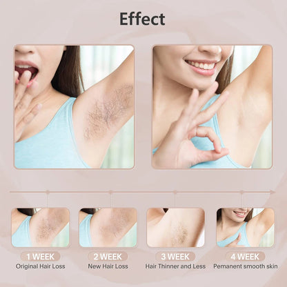 Laser Epilator Laser Permanent Depilator
