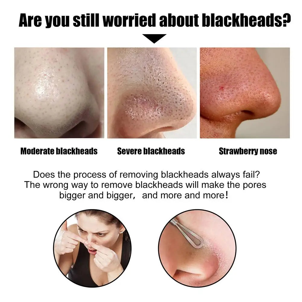 10pcs Box Blackhead Remover Nose Strips
