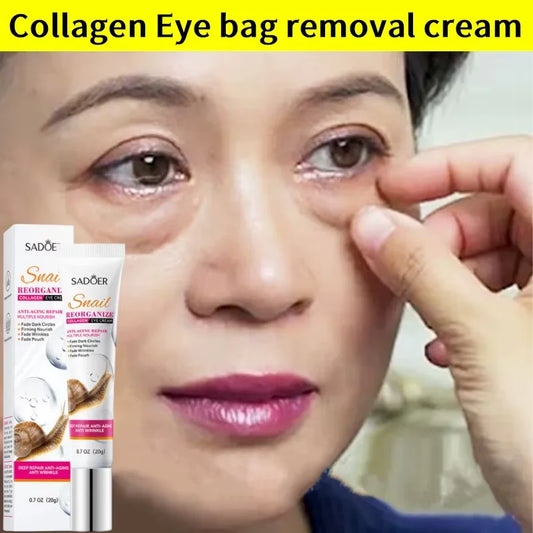 Remove Eye Bags Eye Cream