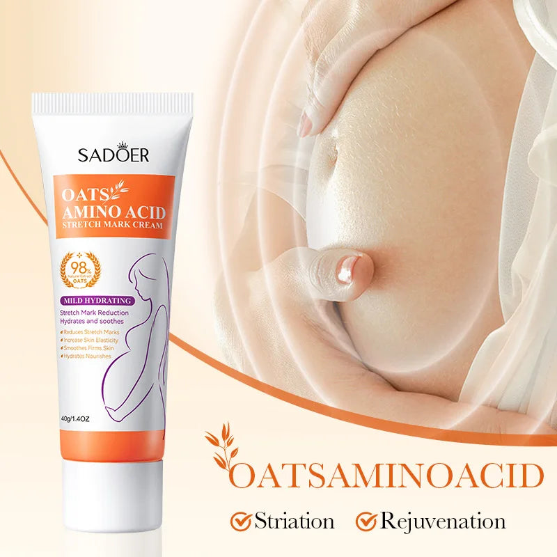 Stretch Marks Permanent Removal Cream