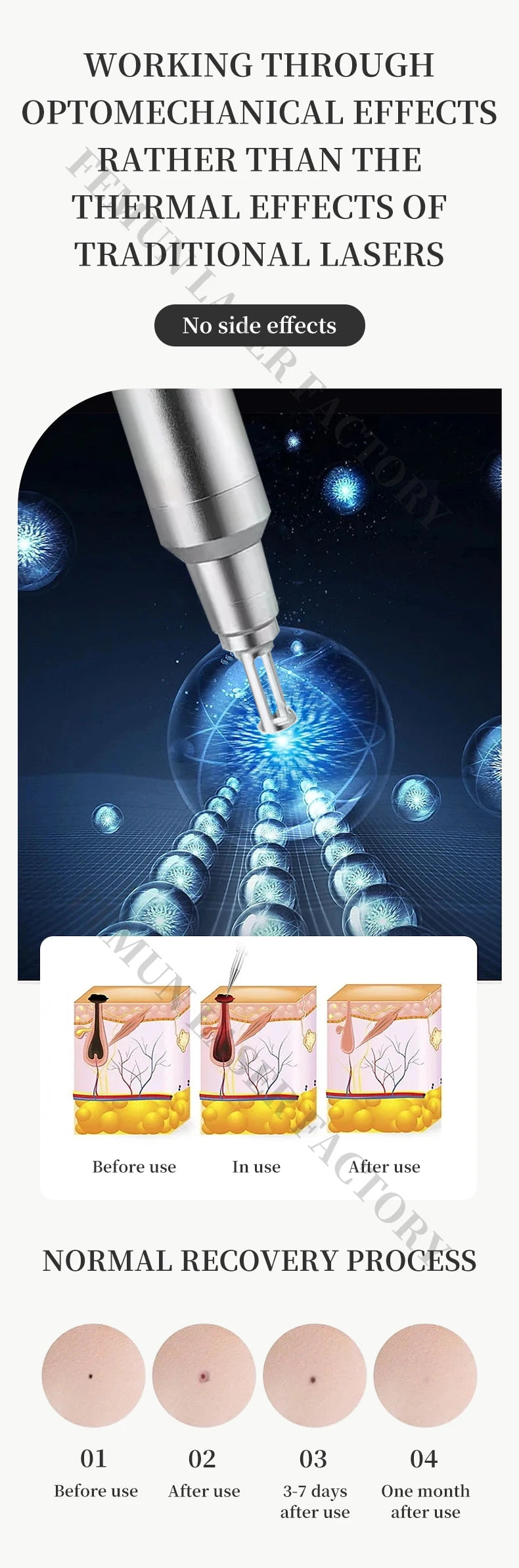 Professional 2 IN 1 Diode Laser 4000w Hair Removal Machine