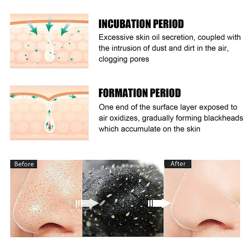 10pcs Box Blackhead Remover Nose Strips