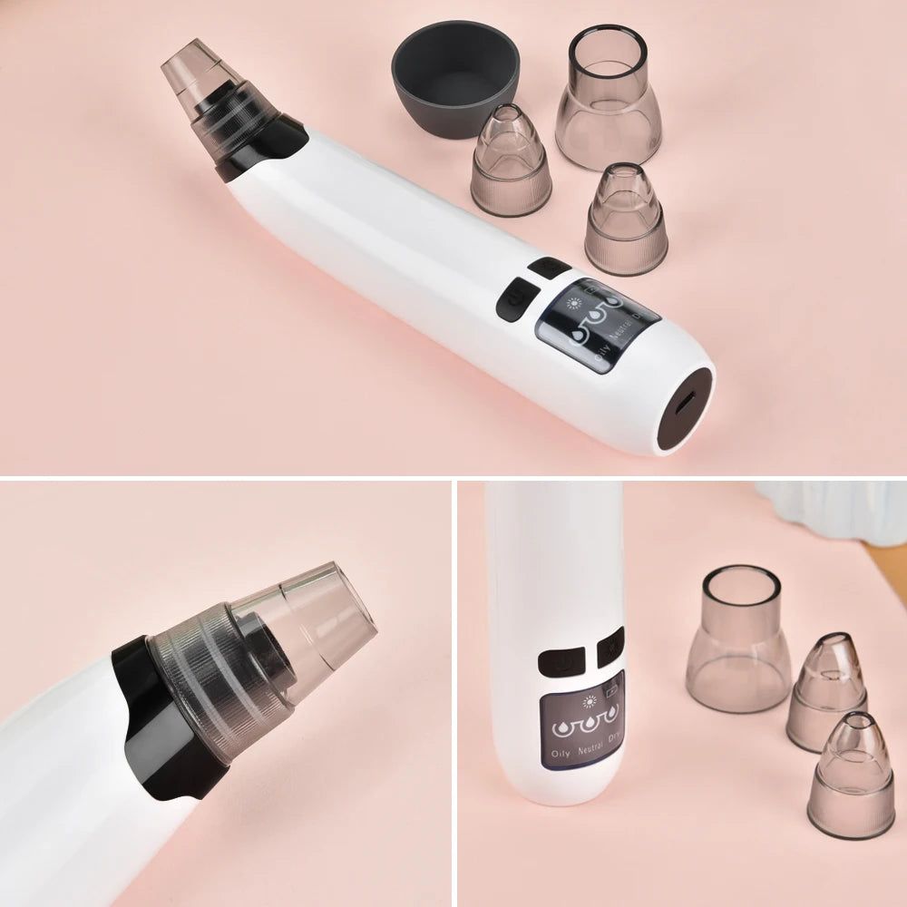 Facial Blackhead Remover Pore Cleaner Heat Function