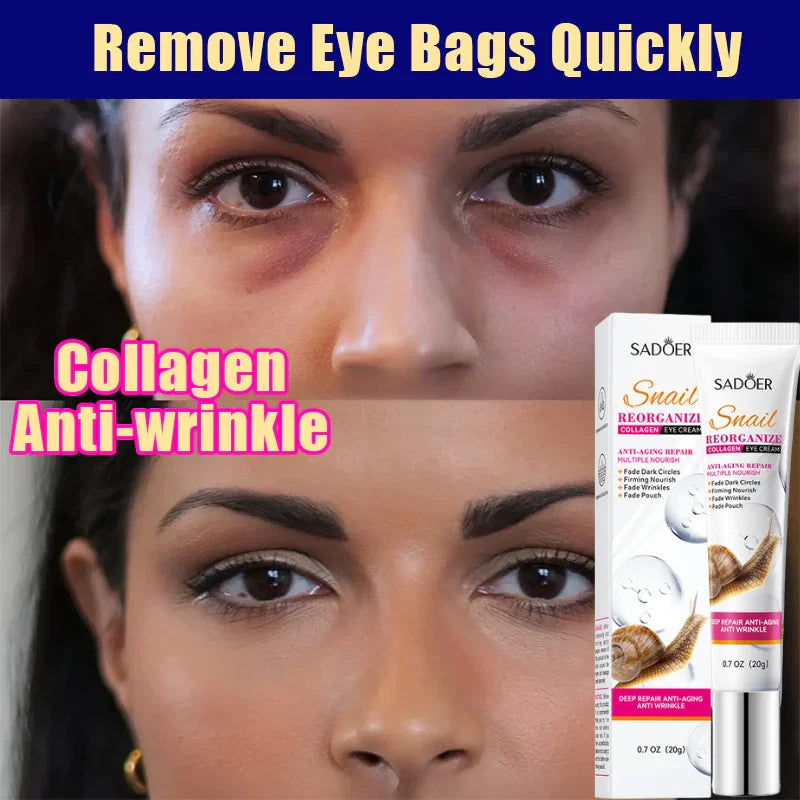 Remove Eye Bags Eye Cream